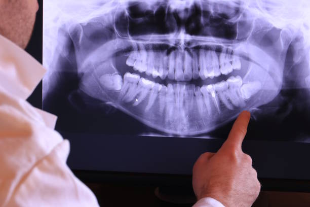 Best Weekend Emergency Dentist in Clemson, SC